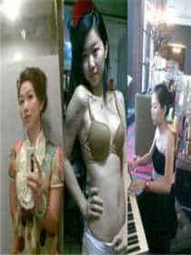 女儿童排尿部长什么样